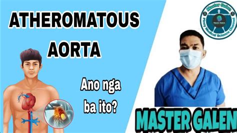 what is atheromatous aorta in tagalog|Ano ang Nagdudulot ng Aortic Aneurysms .